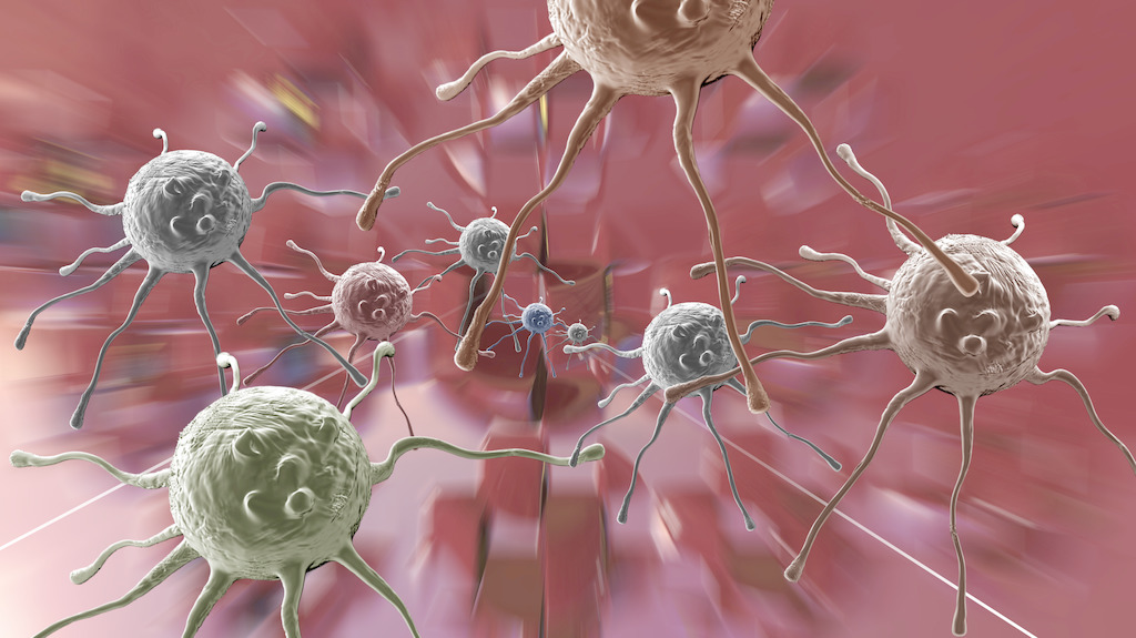 美科学家发明新疗法2小时内可杀死95%的癌细胞