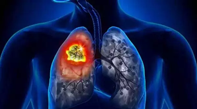 肺癌EGFR耐药后还能再用PD-1吗？
