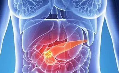 胰腺癌药物早期试验数据喜人：总生存率提高10%